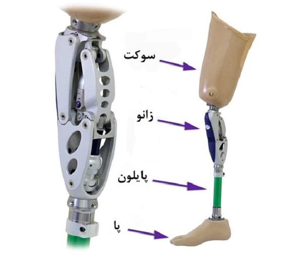 اجزای تشکیل&zwnj;دهنده پروتز پای مصنوعی