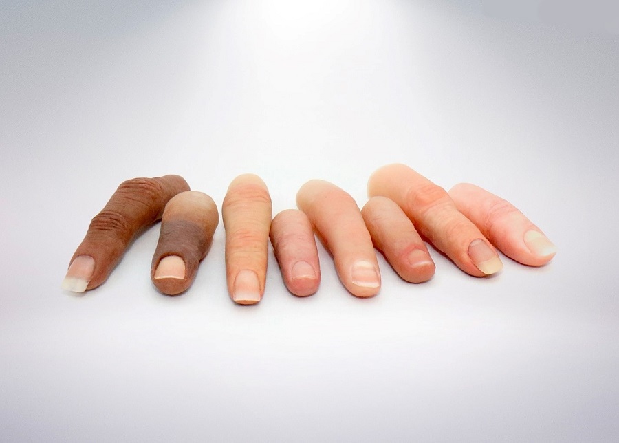 پروتز انگشت چه کاربردی دارد؟