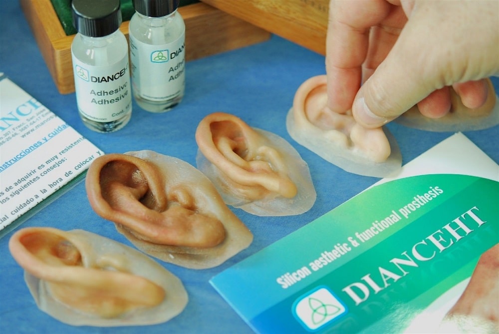 پروتز گوش (گوش مصنوعی) چگونه ساخته می‌شود؟ بررسی مراحل و مراقبت‌ها