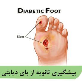 پیشگیری ثانویه از پای دیابتی
