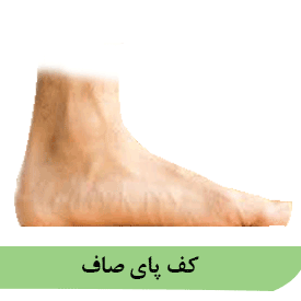 کف پای صاف