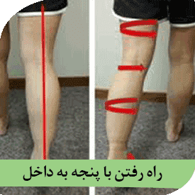 راه رفتن با پنجه به داخل