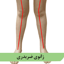 زانوی ضربدری