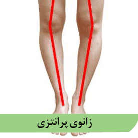 زانوی پرانتزی