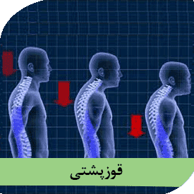 قوز