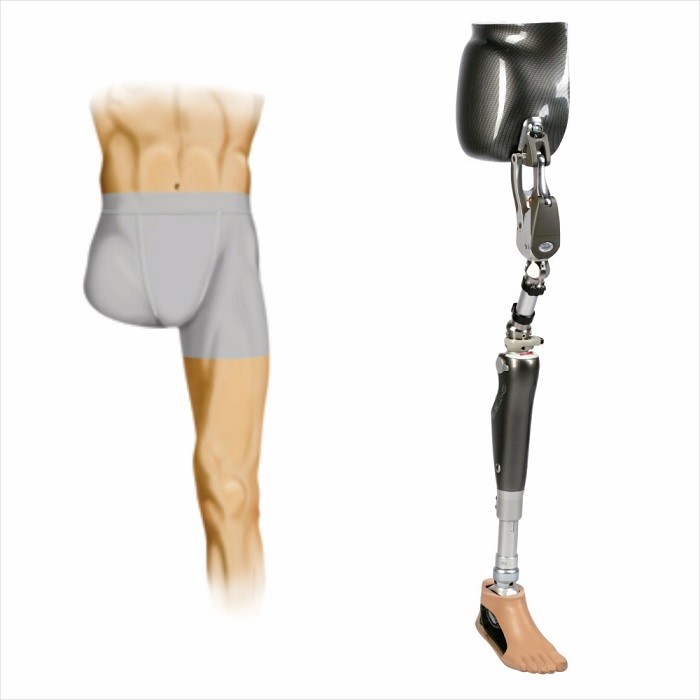 پروتز لگن استفاده از پروتز لگن بعد از قطع کامل پا چگونه است؟