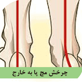 چرخش مچ پا به خارج