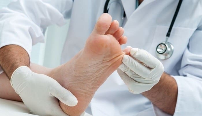 پیشگیری از زخم پای دیابتی با کفش مناسب و کنترل قندخون و وزن