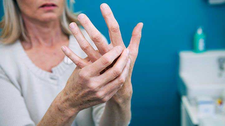 آرتریت روماتوئید انگشتان دست