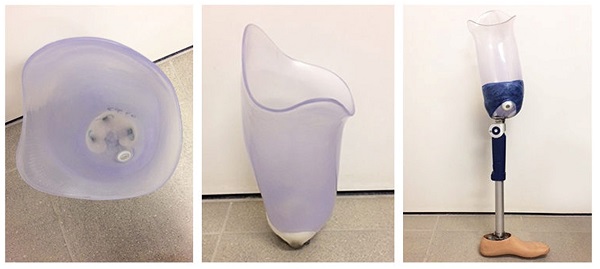 سوکت&zwnj;های پوششی ایسکیال (Ischial Containment Socket)